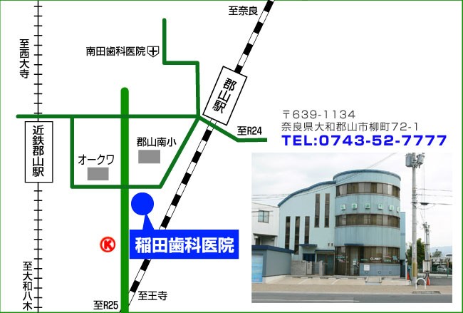 map拡大